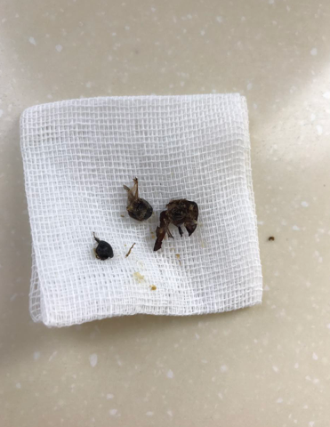 家中墙角用这一物喷一喷蟑螂死光光！非常实用(图4)