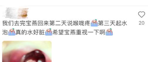 我国脚气患者过亿“祸根”被揪出：这些东西是脚气最大的帮凶(图15)