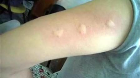 原来蚊子的最大克星不是蚊香？其实驱蚊很简单整晚开窗都不怕(图6)