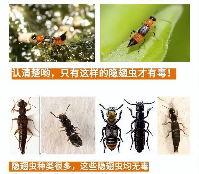 毒液堪比硫酸多人因它“毁容”！遇到这种虫子“别下死手”！(图2)