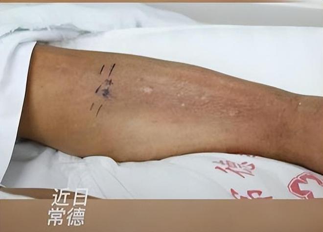 夏天家中蚊子多只用一瓶啤酒蚊子全消灭比蚊香还实用(图3)